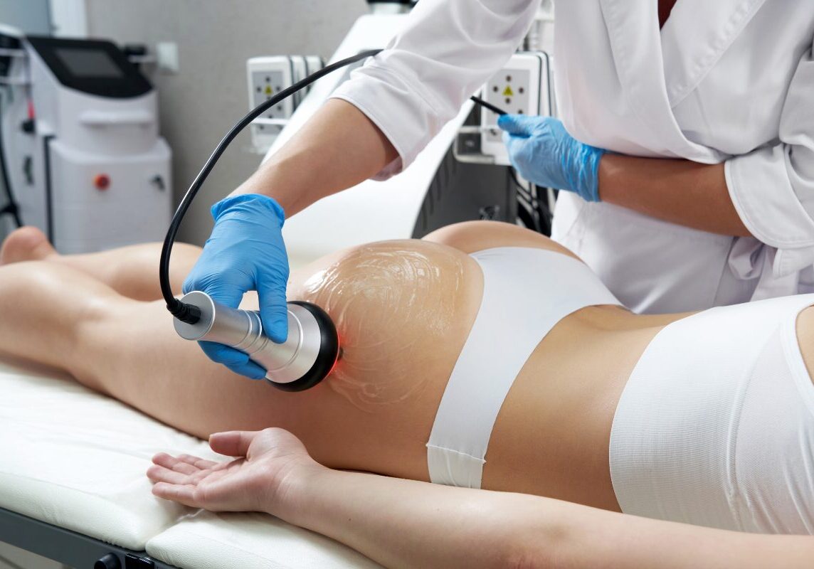 Body-Contouring