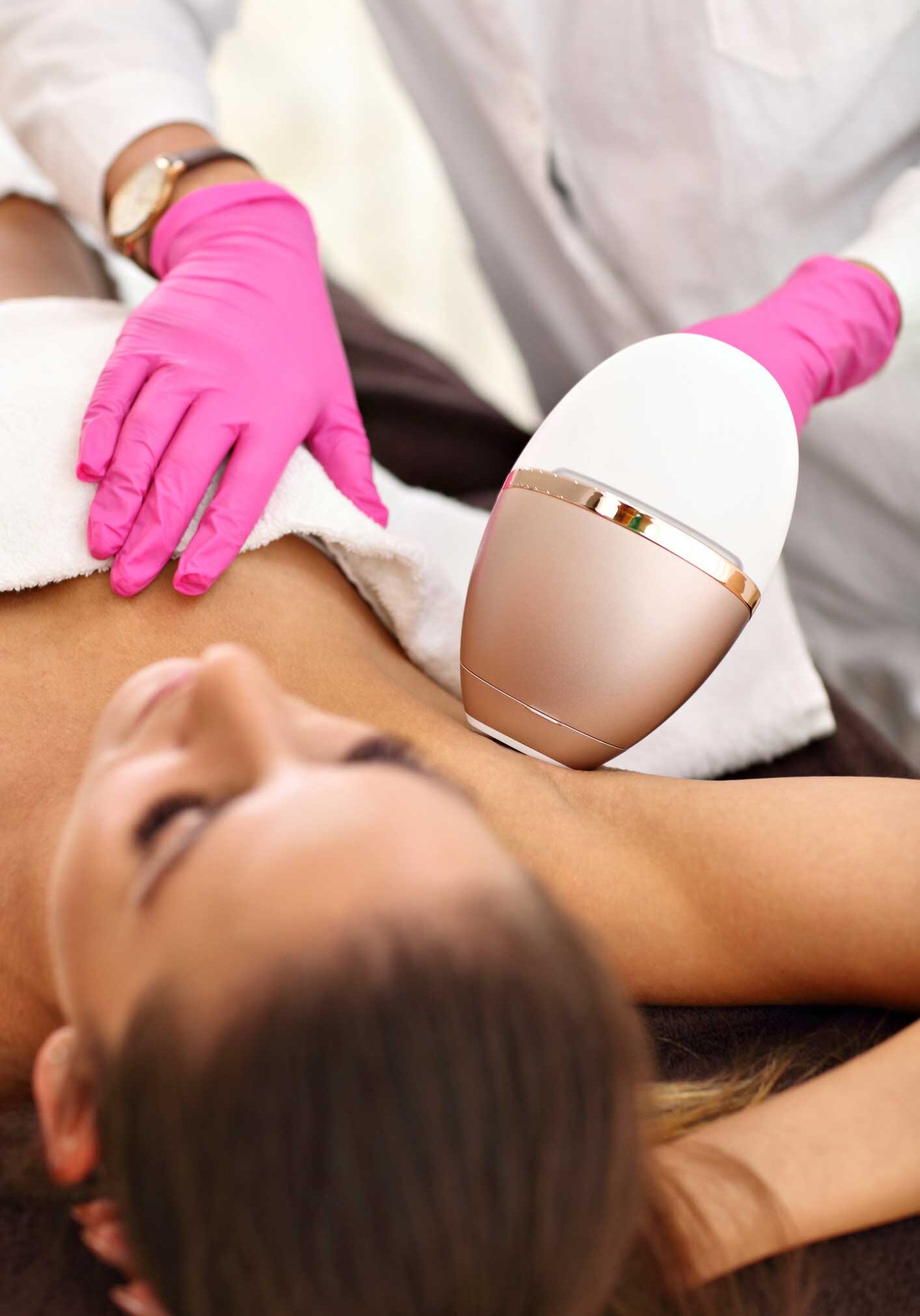 Laser hair removal
