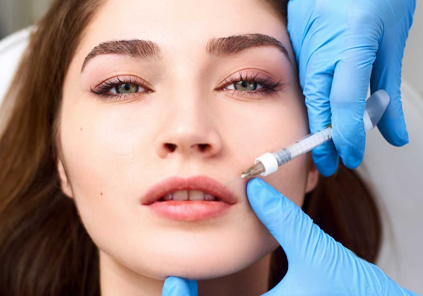 Lip Filler